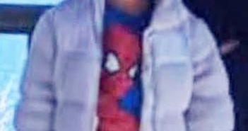 Topun Peşinden Koşan Çocuğa Otomobil Çarptı!