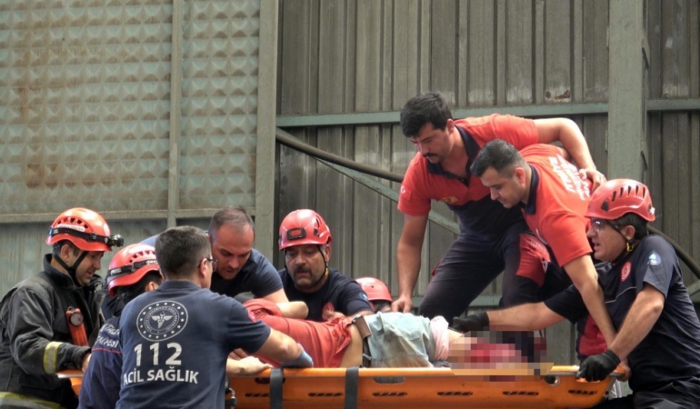 Kırım Makinesine Düşen İşçinin Bacakları Koptu!