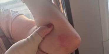 Antalya Havalimanında iniş takımından duman çıkan uçağın yolcuları slayt açılarak tahliye edildi