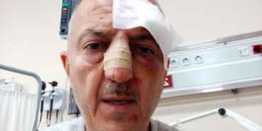 Evden tahliyesi sırasında kendisini darbettiğini öne sürdüğü kayınbiraderinden şikayetçi oldu