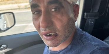 Eğlence mekanında darbedildiği iddiasıyla şikayetçi oldu