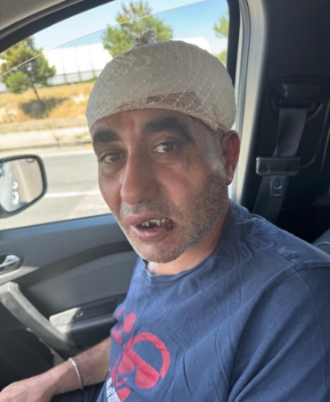 Eğlence mekanında darbedildiği iddiasıyla şikayetçi oldu