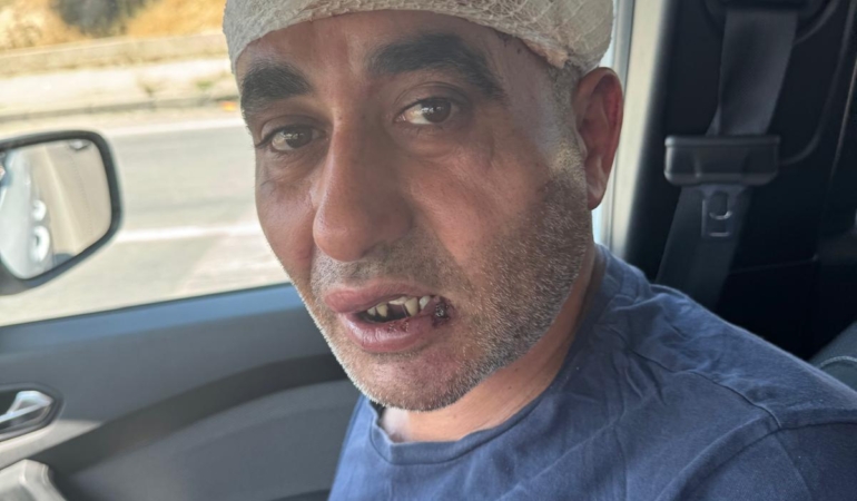 Eğlence mekanında darbedildiği iddiasıyla şikayetçi oldu