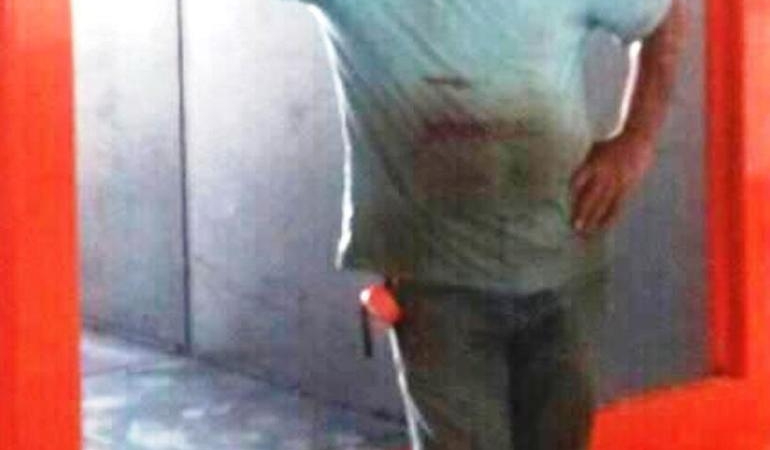 Sevgililerin öldüğü yangın, kundaklama sonucu çıkmış