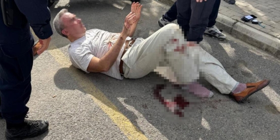 Boşanma aşamasındaki eşini bıçakladı