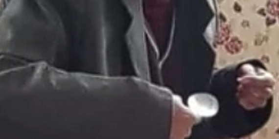 Ölü bulunan zihinsel engellinin vücudunda darp izi (2)