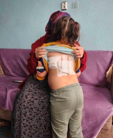 Evinin önünde oynayan çocuğa eşek saldırdı; o anlar kamerada (2)