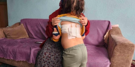 Evinin önünde oynayan çocuğa eşek saldırdı; o anlar kamerada (2)