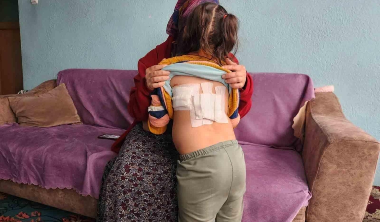 Evinin önünde oynayan çocuğa eşek saldırdı; o anlar kamerada (2)